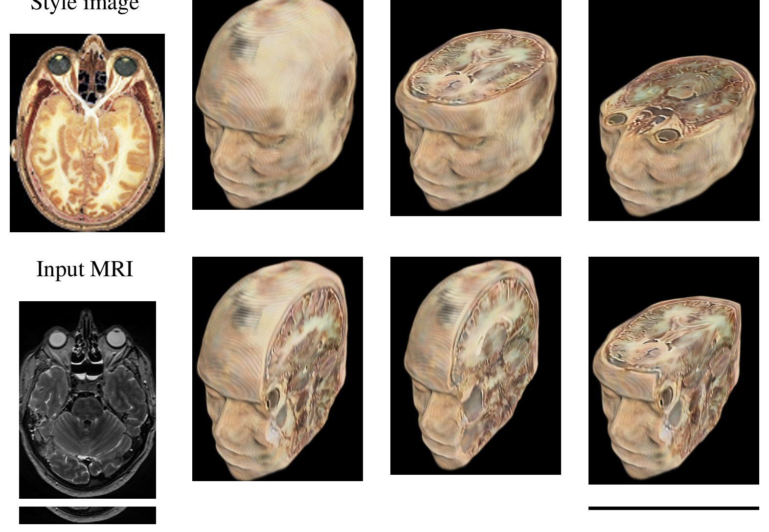 2D to 3D medical image colorization