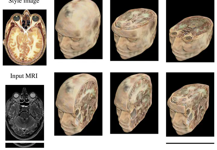 2D to 3D medical image colorization